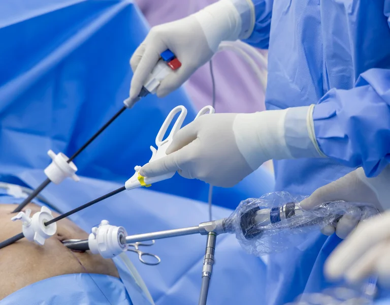 Minimalinvasive Chirurgie