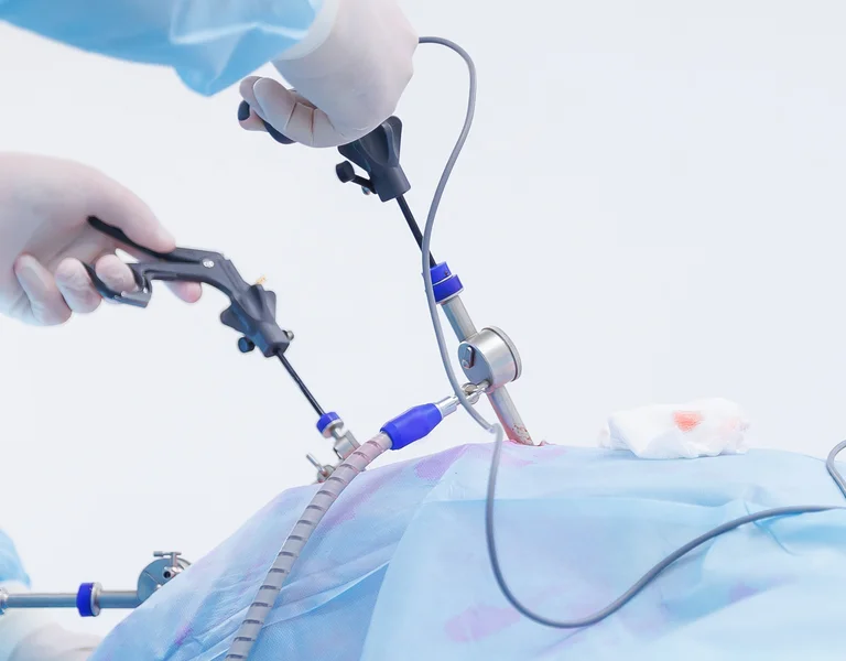 Minimal-invasive OP