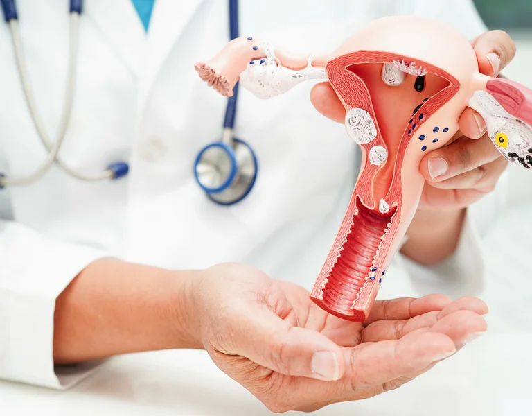 Uterus-Modell