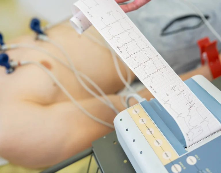 EKG