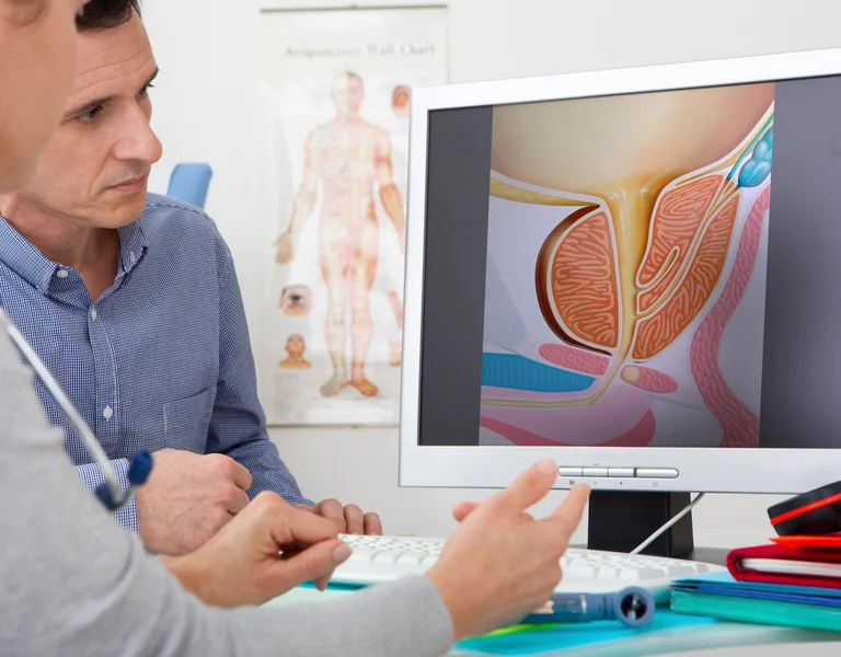 Arzt betrachet mit Patient das Modell einer Prostata am Computer